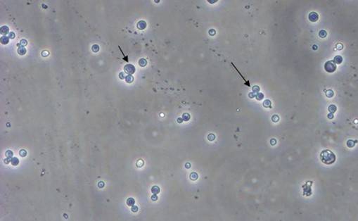 酵母双杂交手艺原理、试验流程、特点以及应用