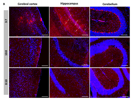 被包裹在含有NT-类脂质的LNP中的Cre重组酶乐成转移。。大脑中的转染神经元呈红色高亮。。