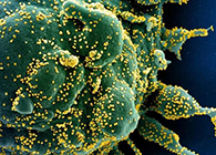 唾液检测新冠抗体新要领来了，，，，获取效果仅需几小时！