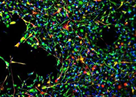 天下首创：药物将干细胞指导至受损部位，，，提高其愈合能力！