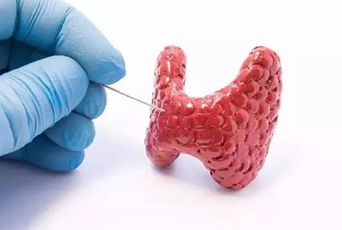 甲状腺疾病，，，，包括甲状腺功效减退和甲状腺功效亢进，，，，自古以来就是重复被医学研究职员研究的疾病