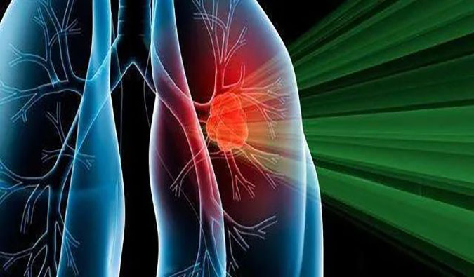 盛世泰科1类立异药物CGT-9475实现中美双报双批 | CC网投一站式临床宿世物医药研发效劳平台助力