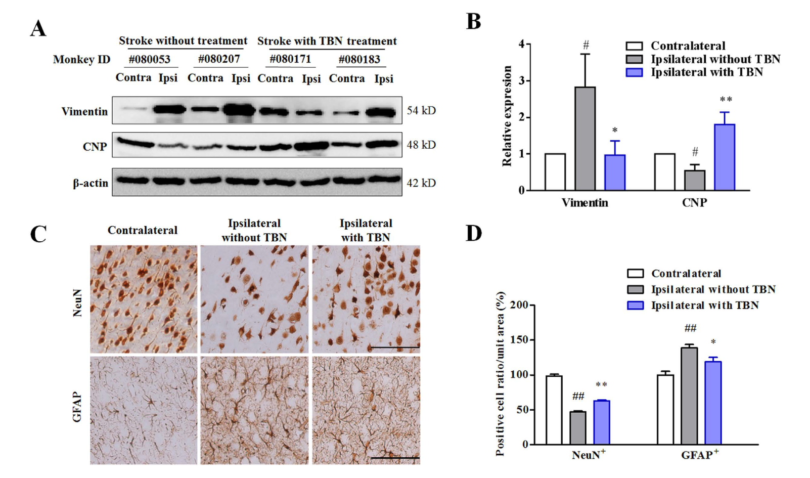 TBN是一种治疗缺血性卒中的新型临床候选药物，，，本研究中TBN通过CC网投合成